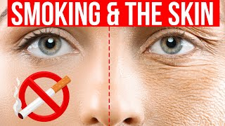 8 skin signs of SMOKING [upl. by Carlynn808]