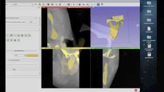 Tutorial Preparing Data for 3D Printing Using 3D Slicer [upl. by Dajma506]