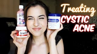 Cystic Acne 3 Affordable Treatments [upl. by Dusty744]