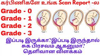 Placenta Grade 0placenta Grade 1 Grade 2Grade 3 என்றால் என்னPlacenta maturity grading in tamil [upl. by Cowan600]