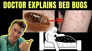 Doctor explains BED BUGS  including SYMPTOMS TREATMENT AND PREVENTION  PHOTOS [upl. by Gonagle]