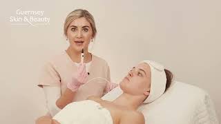 Electrolysis  Short Wave Diathermy Guernsey Skin and Beauty  Ella Harvey [upl. by Ycnay895]