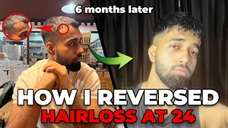 How to stop Hair loss amp Regrow your hairs in 6 Months [upl. by Prissie]