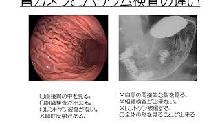 胃カメラを受けるメリット [upl. by Anahoj361]