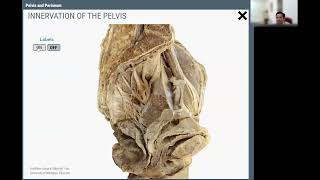 Anatomy of Pelvis [upl. by Ennasus]