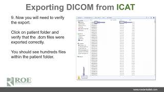 iCAT  how to export DICOM files [upl. by Ranson387]