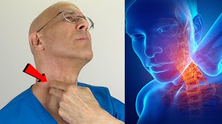 Fix Your Neck Trigger Points in Minutes Become Pain Free  Dr Mandell [upl. by Anstice874]