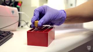 Mayo Clinic Minute Blood test basics [upl. by Justicz]