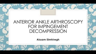 Anterior ankle arthroscopy for impingement decompression [upl. by Biddie]