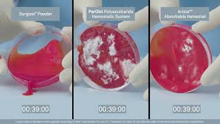 PERCLOT Polysaccharide Hemostatic System Comparison [upl. by Nerhe]