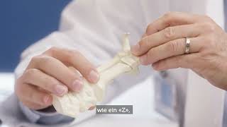 Sprechstunde mit Urs Neurauter Hallux valgus [upl. by Banyaz]