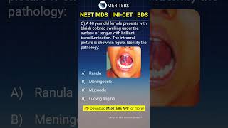 NEET MDS  INICET MDS  PSC  BDS  Most Important Questions neetmds2025 mdsprep [upl. by Idelle732]