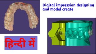 How to design basal implant in exocadHow To Design A Case With Digital ImpressionIntraoral Scanner [upl. by Annairoc]