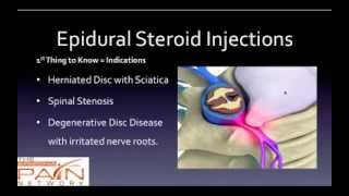 5 Things to Know About Epidural Steroid Injections 602 5076550 [upl. by Fridlund]