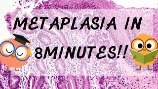 Metaplasia Pathology in 8 Minutes [upl. by Janaya456]