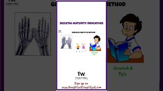 Greulich and Pyle Method shorts dentistry [upl. by Clemens]