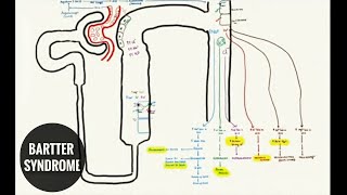 BARTTER SYNDROME and LOOP DIURETICS [upl. by Beattie]