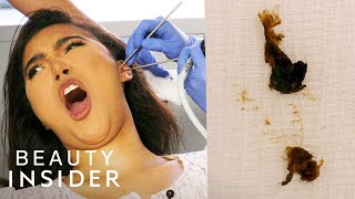 How Earwax Is Professionally Extracted  Beauty Explorers  Insider Beauty [upl. by Aseneg]