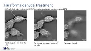 A study on effects of fixation with Formaldehyde and Paraformaldehyde [upl. by Yengac]