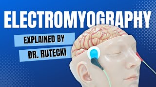 Understanding EMGs Electromyography Tests What Patients Need to Know [upl. by Ihcehcu237]