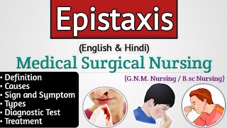 Epistaxis ent lecture  Epistaxis in hindi  Nosebleed [upl. by Ainnek]