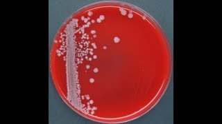 Actinobacillus lignieresii 2 [upl. by Denman]