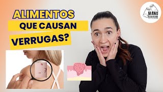 🤯Verrugas en el cuello 5 alimentos que las causan ¡No los comas más  ACROCORDONES Manu Echeverri [upl. by Sdlonyer]