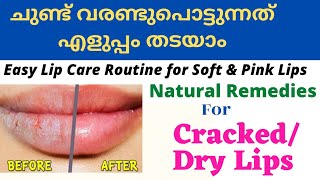 ചുണ്ട് വരണ്ടുപോട്ടുന്നത് തടയാൻDryCracked Lips Home Remedy MalayalamLip Care for Soft Lips [upl. by Ramyaj462]