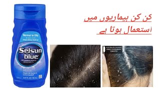 selsun blue shampoo uses complete review [upl. by Earej626]