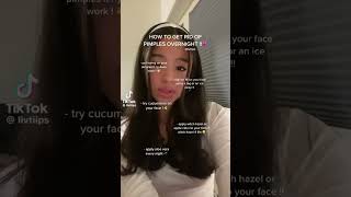 how to get rid of pimples overnight  notmine tiktok tips4u [upl. by Alburga]