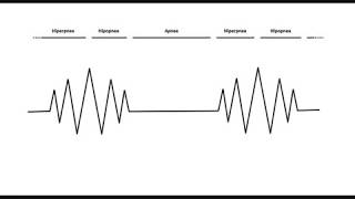 Valoración de Enfermería Respiración de Cheyne Stokes [upl. by Zosima]