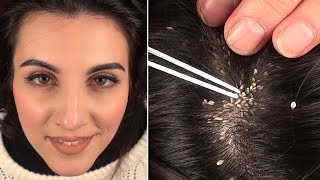 ASMR “Realistic” Lice Check Fake Lice Tweezers Chopsticks [upl. by Nwahsyt]