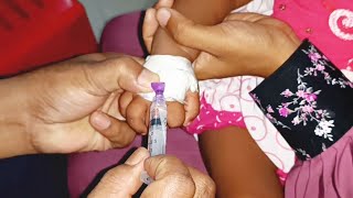 Meropenem injection Cannula  Child  তে Push 24 Ep 39 By Injection Tv [upl. by Aicener]