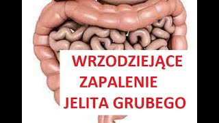 WYZDROWIEJESZ 60  76 WRZODZIEJĄCE ZAPALENIE JELITA GRUBEGO [upl. by Seldun]