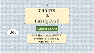 ChartCANCER CERVIX Pathology RATS MBBS SRM Dr GSS University Exam [upl. by Chamberlain]