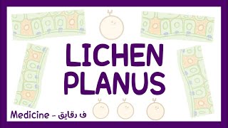 Lichen planus  definition pathophysiology types clinical picture diagnosis amp treatment شرح عربي [upl. by Oiraved792]