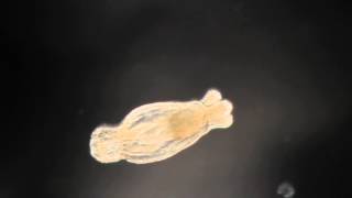 Nematostella vectensis Developing Polyp BIOHOPK 160H [upl. by Tildie]