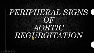 SIGNS OF AORTIC REGURGITATION with videos for all signs [upl. by Lazos]