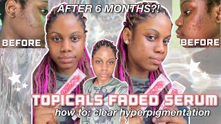 I used the TOPICALS FADED serum for 6 MONTHS and this happened [upl. by Esened426]