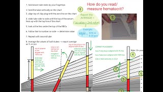 Hematocrit Review [upl. by Yblok274]