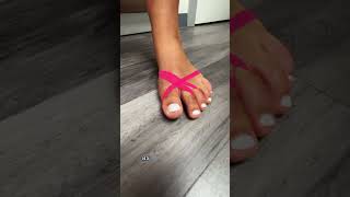 MINIMALLY INVASIVE BUNION SURGERY🤩shorts bunions [upl. by Florry]