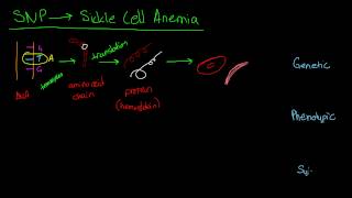 The Curious Case of Sickle Cell Anemia [upl. by Atwood]