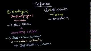 Neisseria meningitidis infection [upl. by Annavoig]