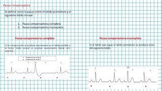 Latidos prematuros latidos ectópicos extrasístoles  Clases EKG 32 [upl. by Ansaev]