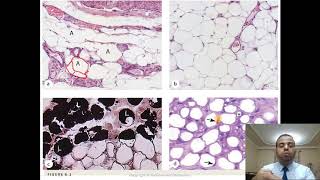 6 Adipose Tissue [upl. by Romina]