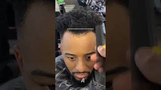 200 Hairline Restoration [upl. by Rasure]