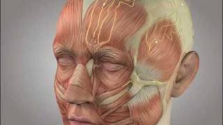 Migraine surgery video animation [upl. by Arman]