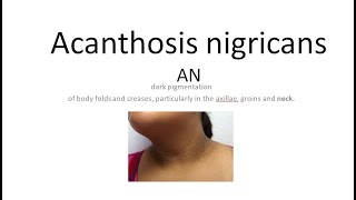 Medicine 1175 Acanthosis nigricans causes insulin resistance treatment skin dermatology dark line [upl. by Dena]