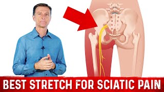 Best Stretches for Sciatica Nerve Pain Relief – Dr Berg [upl. by Gibbons881]