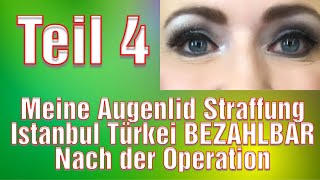 Schlupflider Operation Vorher Nachher Augenlidstraffung Erfahrung Türkei Oberlidstraffung [upl. by Augustine925]